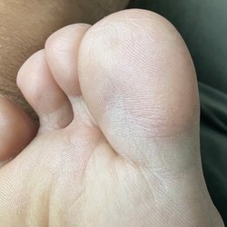 Robert Bello: Family Foot and Leg Center - North Naples
