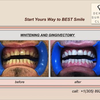 Elena Sinilo-Katz, DMD - General Dentistry Near Me - North Miami, Florida Elena Sinilo-Katz, DMD - General Dentistry Near Me - North Miami, Florida