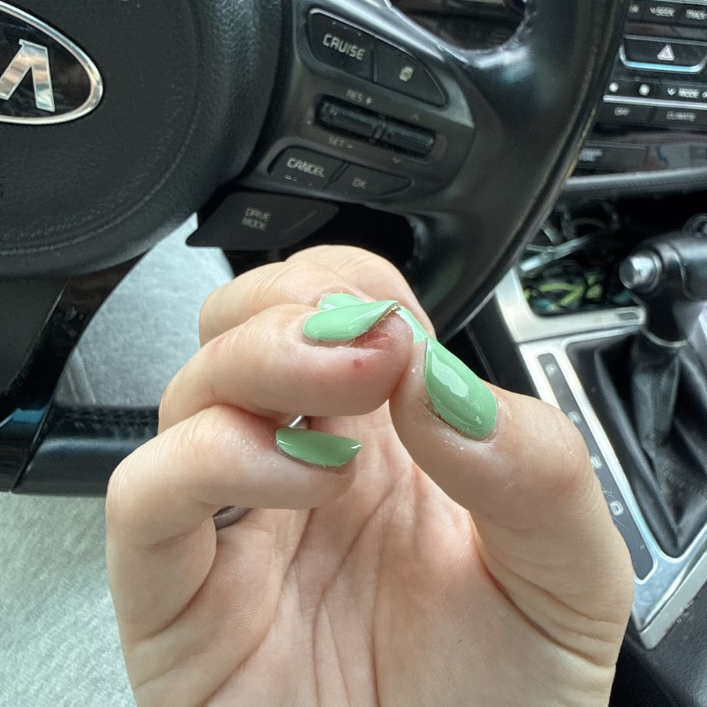 Allure Nail Spa - Cut her finger open - Nail Salons Near Me - Atlanta, Georgia Allure Nail Spa - Cut her finger open - Nail Salons Near Me - Atlanta, Georgia
