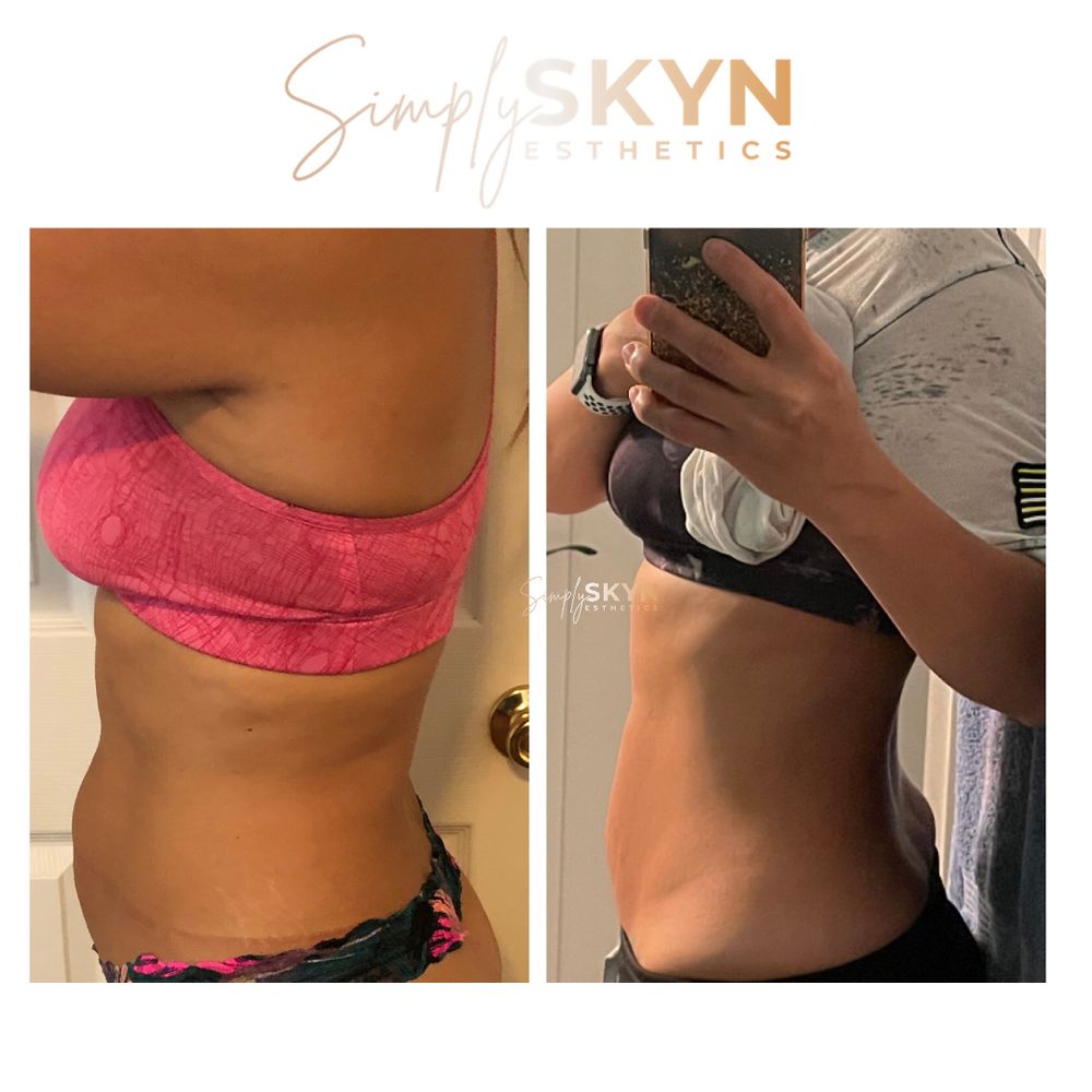 Simply Skyn Esthetics Logo