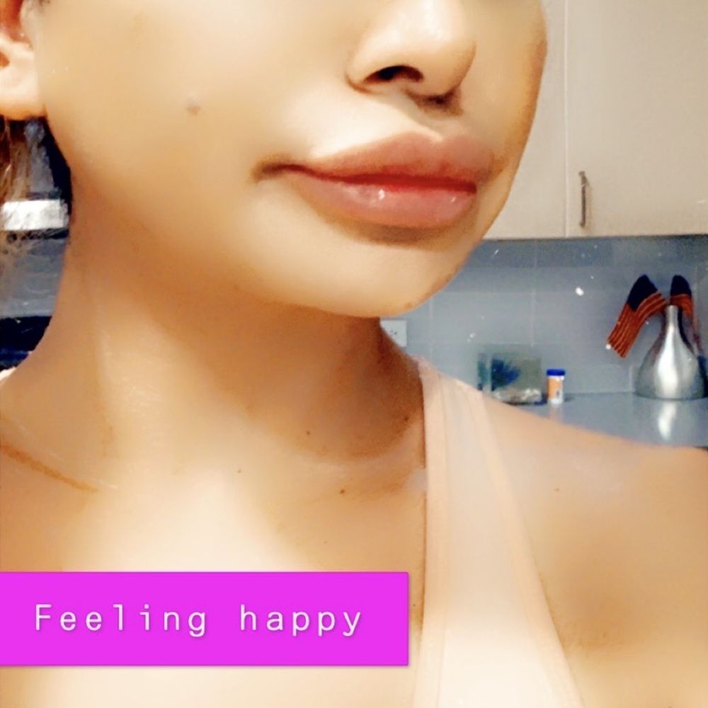 Pure Cell New Life Solutions - Lip injections - Medical Spas Near Me - Pasadena, California