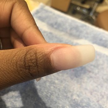 Allure Nail Spa - The nail that needed a fill in immediately - Nail Salons Near Me - Kennesaw, Georgia Allure Nail Spa - The nail that needed a fill in immediately - Nail Salons Near Me - Kennesaw, Georgia