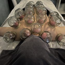 Sammi Spa - Cupping