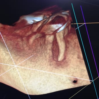 Hudson Valley Endodontics - cone beam 3D technology which makes diagnosis and treatment more concise - Endodontists Near Me - Kingston, New York Hudson Valley Endodontics - cone beam 3D technology which makes diagnosis and treatment more concise - Endodontists Near Me - Kingston, New York