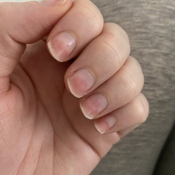 Gloss Nail Bar - Went in for a nail removal and they over filed my natural nails down. Horrible service and ethics! - Nail Salons Near Me - Anaheim, California Gloss Nail Bar - Went in for a nail removal and they over filed my natural nails down. Horrible service and ethics! - Nail Salons Near Me - Anaheim, California