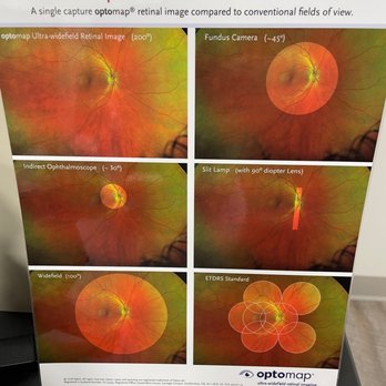Visionworks - Optometrists Near Me - Sparks, Nevada