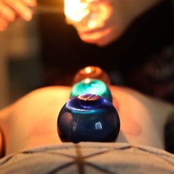 Victoria’s Massageology - Fire cupping is an excellent way to break up scar tissue and relieve aches and pains!