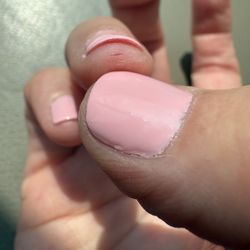 Pretty Nails - I have a cut from my nail being filed too aggressively with a very course emery board!