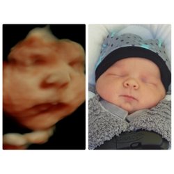 Coeur d'Alene Ultrasound - HD Live Before and After