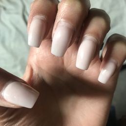 Nail growth at 5 weeks Nail growth at 5 weeks