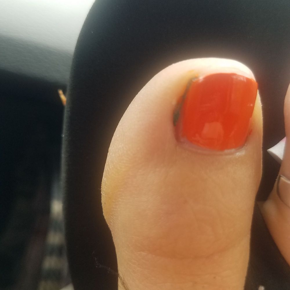 My nails were turquoise before and you can still see the old nail polish on the side of my toenails. My nails were turquoise before and you can still see the old nail polish on the side of my toenails.