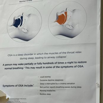 Gammie HomeCare  - A great description of what sleep apnea is - Medical Supplies Near Me - Aiea, Hawaii
