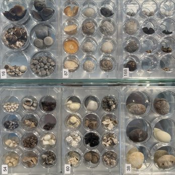 Medizinhistorisches Museum der Charité - Gallstones of all sizes... - Museums Near Me - Berlin, BE