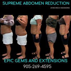 Epic Gems and Extensions - Supreme Abdomen Reduction