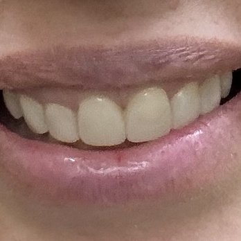 Monica Crooks, DDS - Final - Cosmetic Dentists Near Me - Sacramento, California Monica Crooks, DDS - Final - Cosmetic Dentists Near Me - Sacramento, California
