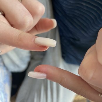 Crescent Nails - Cut and possibly an infection - Nail Salons Near Me - Bend, Oregon