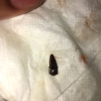 China Hut - a tiny insect on a piece of paper - Chinese Near Me - Boynton Beach, Florida