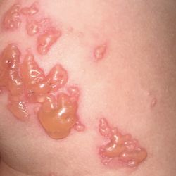 Associated Dermatologists