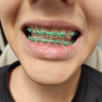 1. Tru Orthodontics - Fairfax