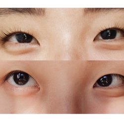 Before lash lift (bottom), after lash lift (top)