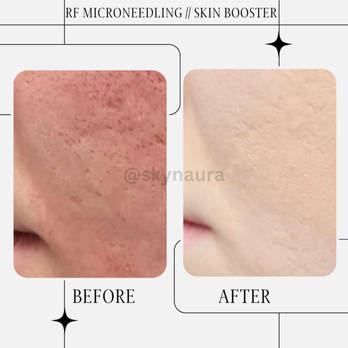 Skyn Aura - Medical Spas Near Me - Irvine, California Skyn Aura - Medical Spas Near Me - Irvine, California