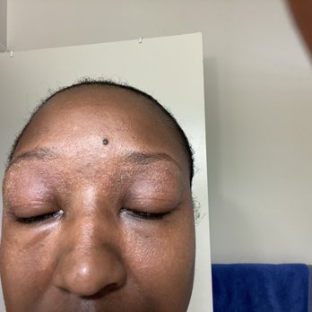 The Nails Spa - Allergic reaction after eyebrow waxing ... it's getting worse each day. - Nail Salons Near Me - Washington, DC, District of Columbia