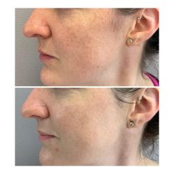 Victoria Kartseva - Ritual - BBL Treatment