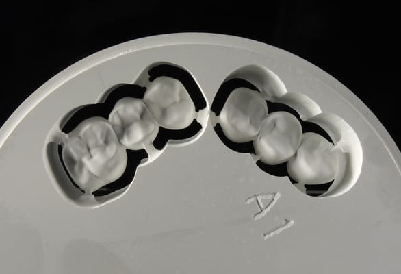 UDELL DENTAL LABORATORY - Updated April 2025 - 3361 Gorham Ave, St ...