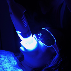 Sirius Glow Teeth Whitening