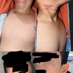 Inglewood Unified School District - He was choked by his bully and they are not taking this seriously!!