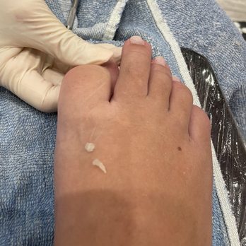 Miracles Nails & Spa - Ingrown toenail removal - Nail Salons Near Me - Las Vegas, Nevada Miracles Nails & Spa - Ingrown toenail removal - Nail Salons Near Me - Las Vegas, Nevada