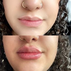 The Medical Skin Clinic - Before and after.