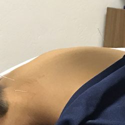 Acupuncture & Healing Arts Center