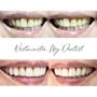 My Dentist