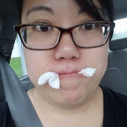 Lehigh Oral & Maxillofacial Surgery - 8/31/18: Right after the wisdom teeth extraction