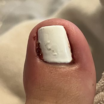 Nails Art - My toe all torn up. - Nail Salons Near Me - Cypress, California