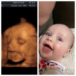 First Expressions Ultrasound - 3D ultrasound at 25 weeks and baby at 5 months old