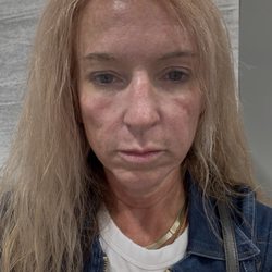 Bayou City Dermatology - After