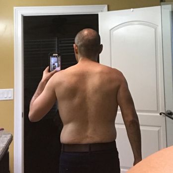 Valdez Chiropractic - My lower back is now pain free thanks to Dr. Valdez. - Chiropractors Near Me - Montebello, California