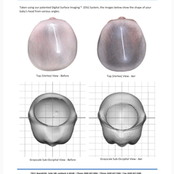 Cranial Technologies - Report: Before/After 3