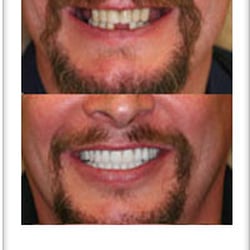 Steven A Kollander, DDS - Dental Implants