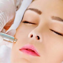 Secret Beauty Esthetic Spa - Microdermabrasion