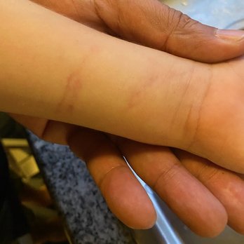 Mountain View Community Church - Injuries of my youngest son. - Churches Near Me - Fontana, California
