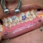 Photo of Pearlfect Smile