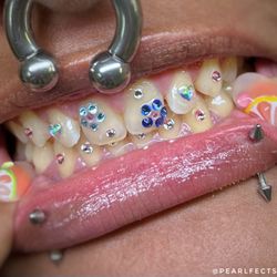 Pearlfect Smile - Freestyle Tooth Gem Set