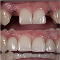 Cornell Dental - Before and After