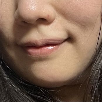 Peach & Fox - BEFORE facial. Picture of my natural skin without any makeup or filter on (post-workout) - Skin Care Near Me - New York, New York Peach & Fox - BEFORE facial. Picture of my natural skin without any makeup or filter on (post-workout) - Skin Care Near Me - New York, New York