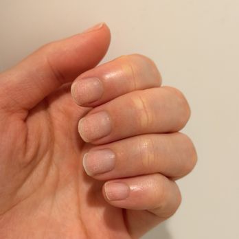 Nature Love Salon - Over filed nails, zoom in to see rough filing marks. - Nail Salons Near Me - Sacramento, California Nature Love Salon - Over filed nails, zoom in to see rough filing marks. - Nail Salons Near Me - Sacramento, California
