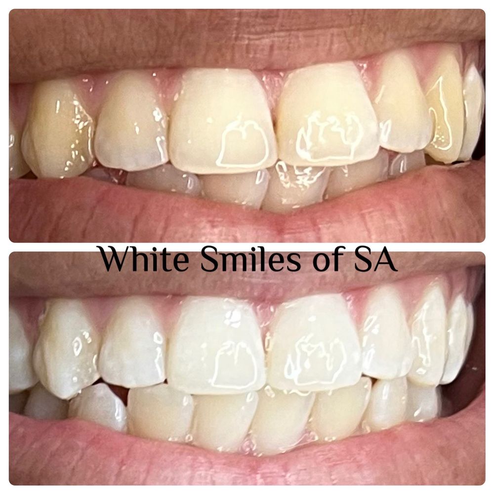 WHITE SMILES OF SA Updated August 2024 Request an Appointment