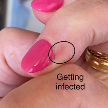 Highland Nails & Spa - Nail tech cut cuticle - now getting infected - Nail Salons Near Me - Flower Mound, Texas Highland Nails & Spa - Nail tech cut cuticle - now getting infected - Nail Salons Near Me - Flower Mound, Texas
